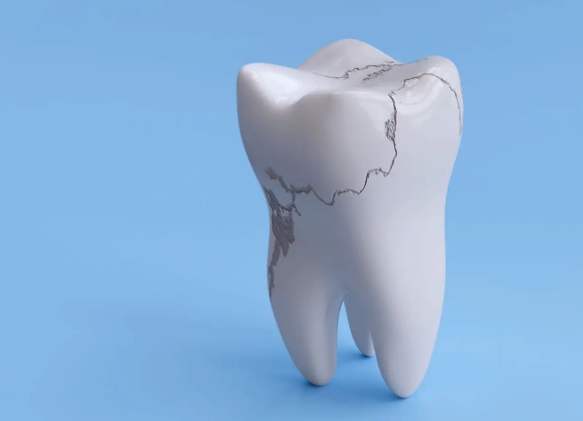 Dlaczego szkliwo zębów się osłabia i jak je wzmocnić?