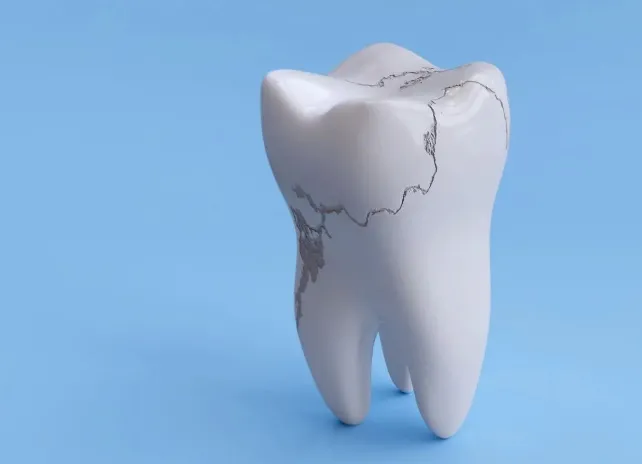 Jak rozpoznać, że szkliwo zębów wymaga odbudowy?